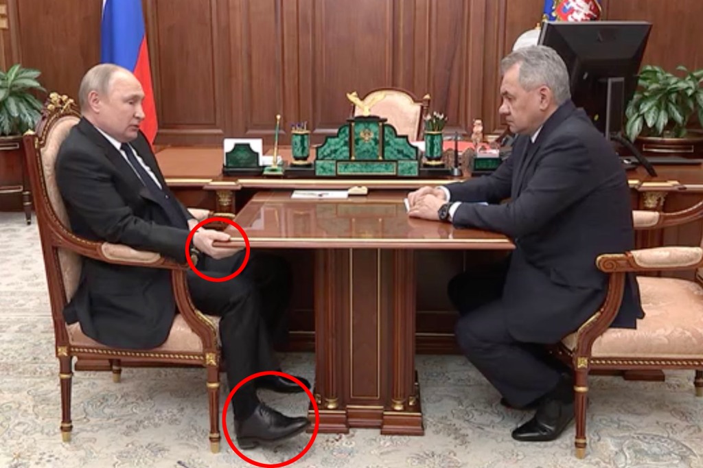 Vladimir Putin is seen puffy clutching a table while lying in his chair during a televised meeting with his defense minister amid rumors that the Russian strongman is battling cancer.